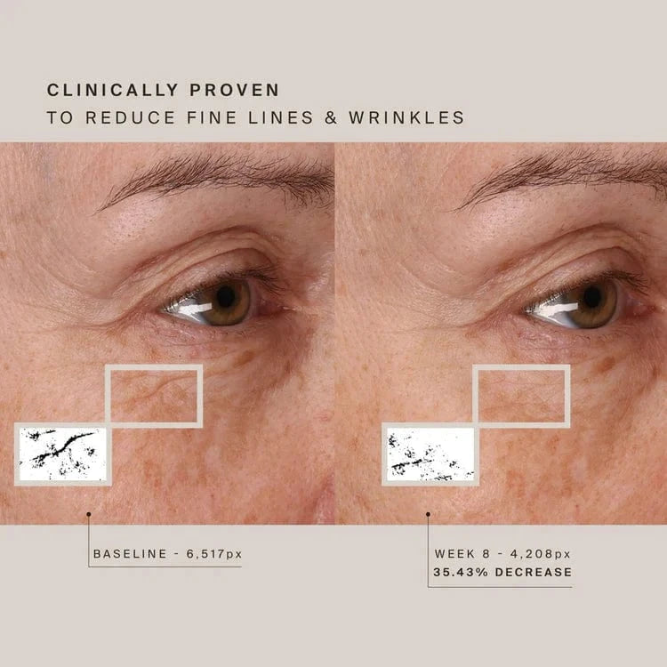 HigherDose Wellness Red Light Face Mask
