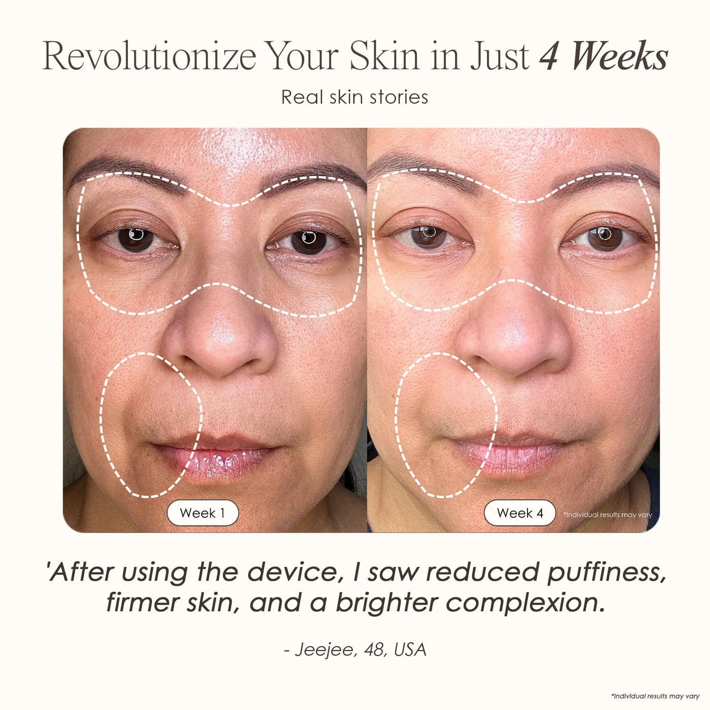 Project E Beauty Skin Care LumaLux Face | Pro LED Light Therapy Mask