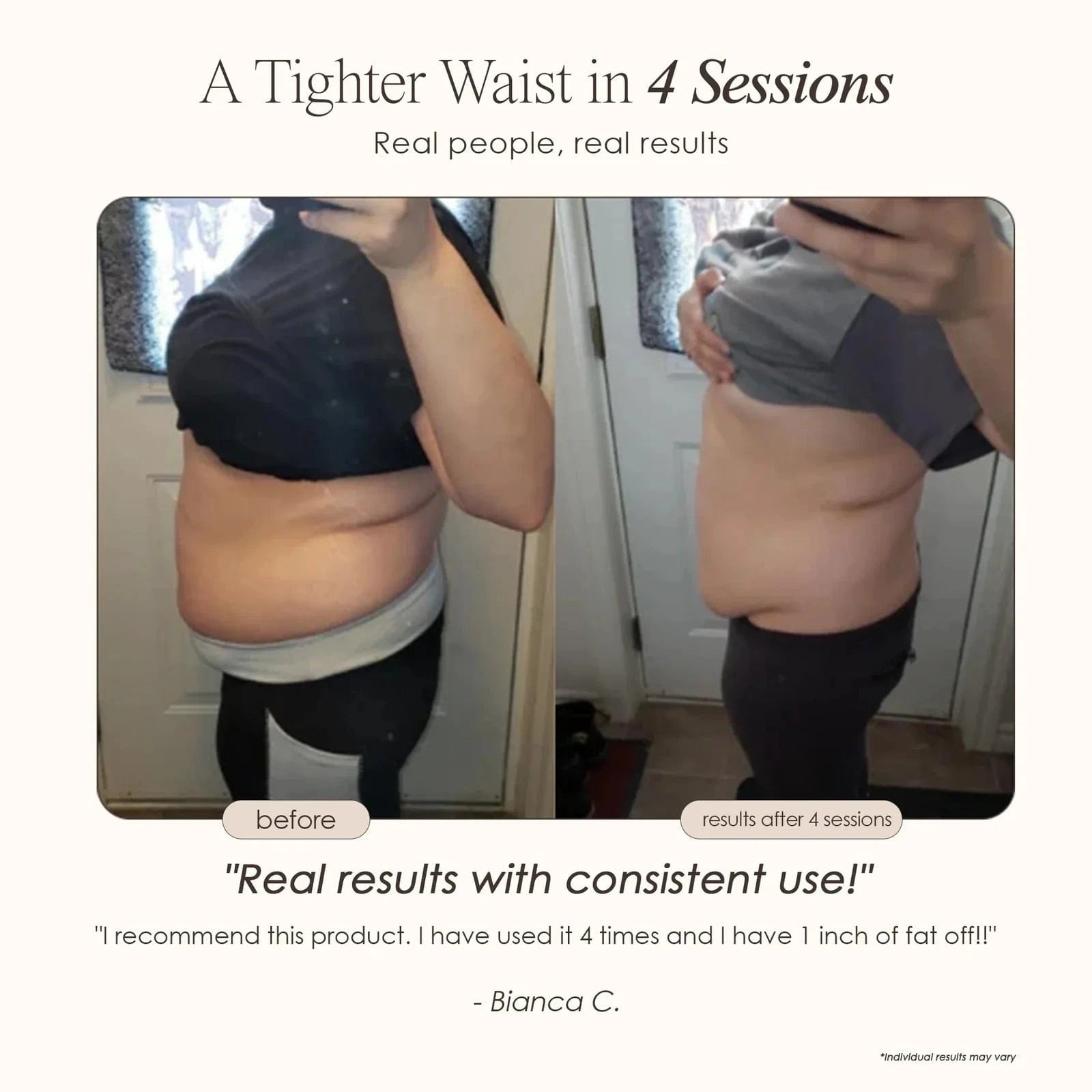 BodySculpt | LED RF Beauty System Skin Care Project E Beauty project-e-beauty-skin-care-bodysculpt-led-rf-beauty-system-1160874664