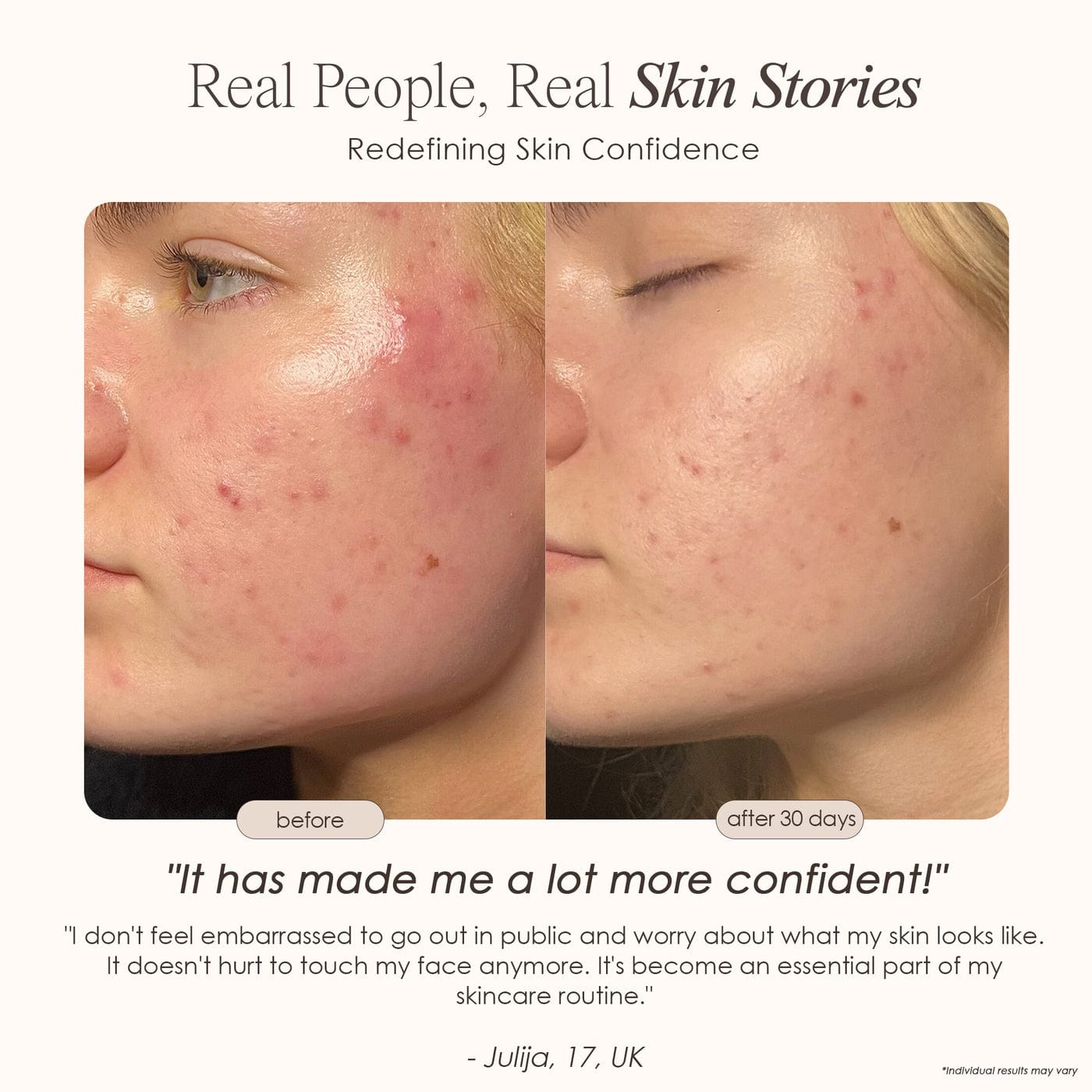LightAura | LED Face Mask Skin Care Project E Beauty project-e-beauty-skin-care-lightaura-led-face-mask-1159432378