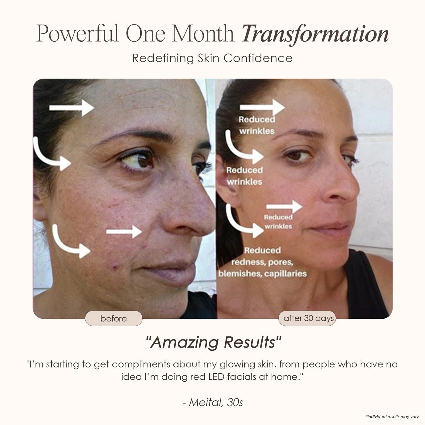 LightAura | LED Face Mask Skin Care Project E Beauty project-e-beauty-skin-care-lightaura-led-face-mask-1159432379