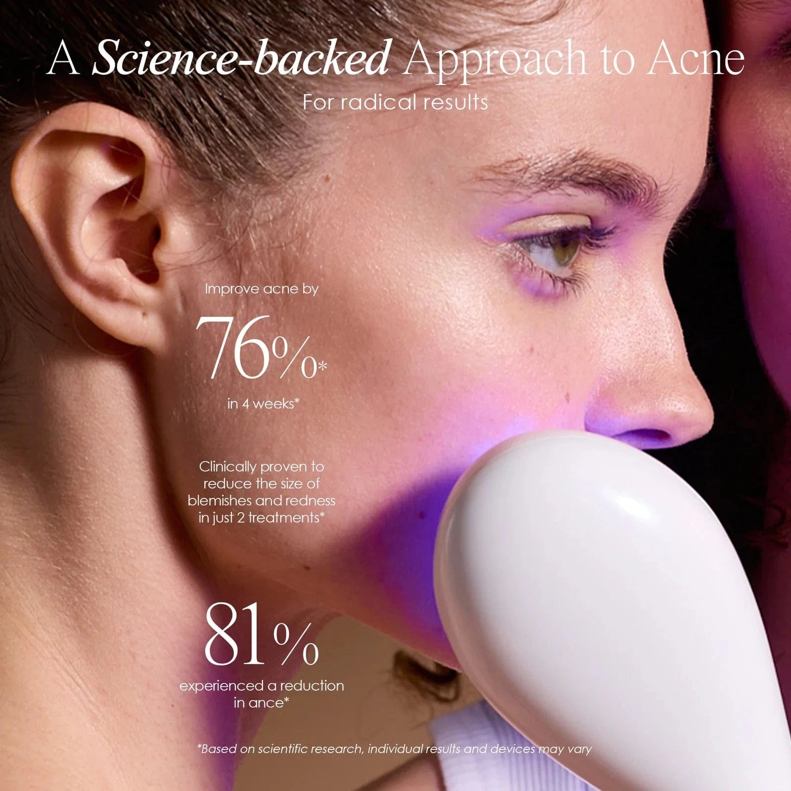 LumaGlow Blue | Anti-Acne LED Light Therapy Wand Skin Care Project E Beauty project-e-beauty-skin-care-lumaglow-blue-anti-acne-led-light-therapy-wand-1159964996