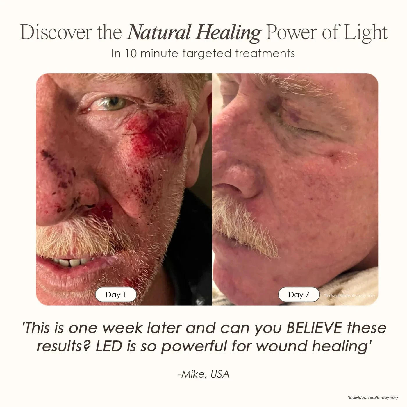 LumaLux Dome | Face & Body LED Light Therapy Device Skin Care Project E Beauty project-e-beauty-skin-care-lumalux-dome-face-body-led-light-therapy-device-1159432396