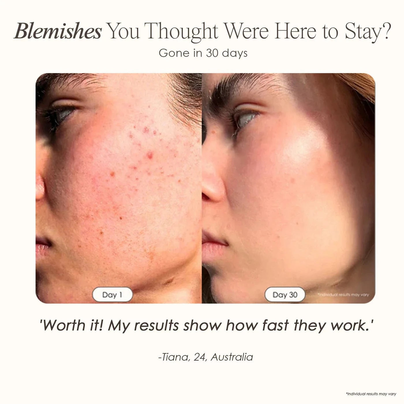 LumaLux Dome | Face & Body LED Light Therapy Device Skin Care Project E Beauty project-e-beauty-skin-care-lumalux-dome-face-body-led-light-therapy-device-1159432401
