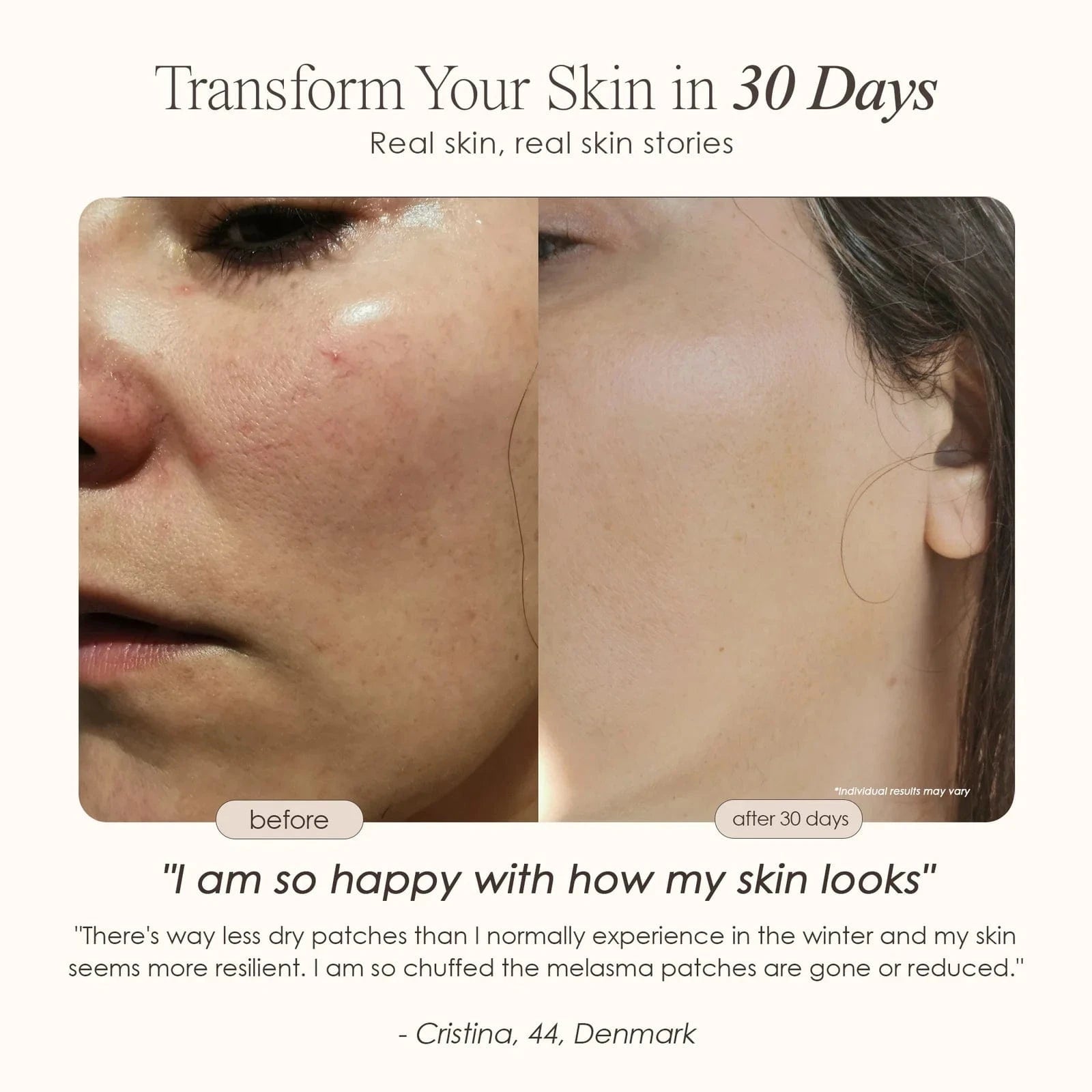 Lumamask 7 | LED Light Therapy Face Mask Skin Care Project E Beauty project-e-beauty-skin-care-lumamask-7-led-light-therapy-face-mask-1160874676