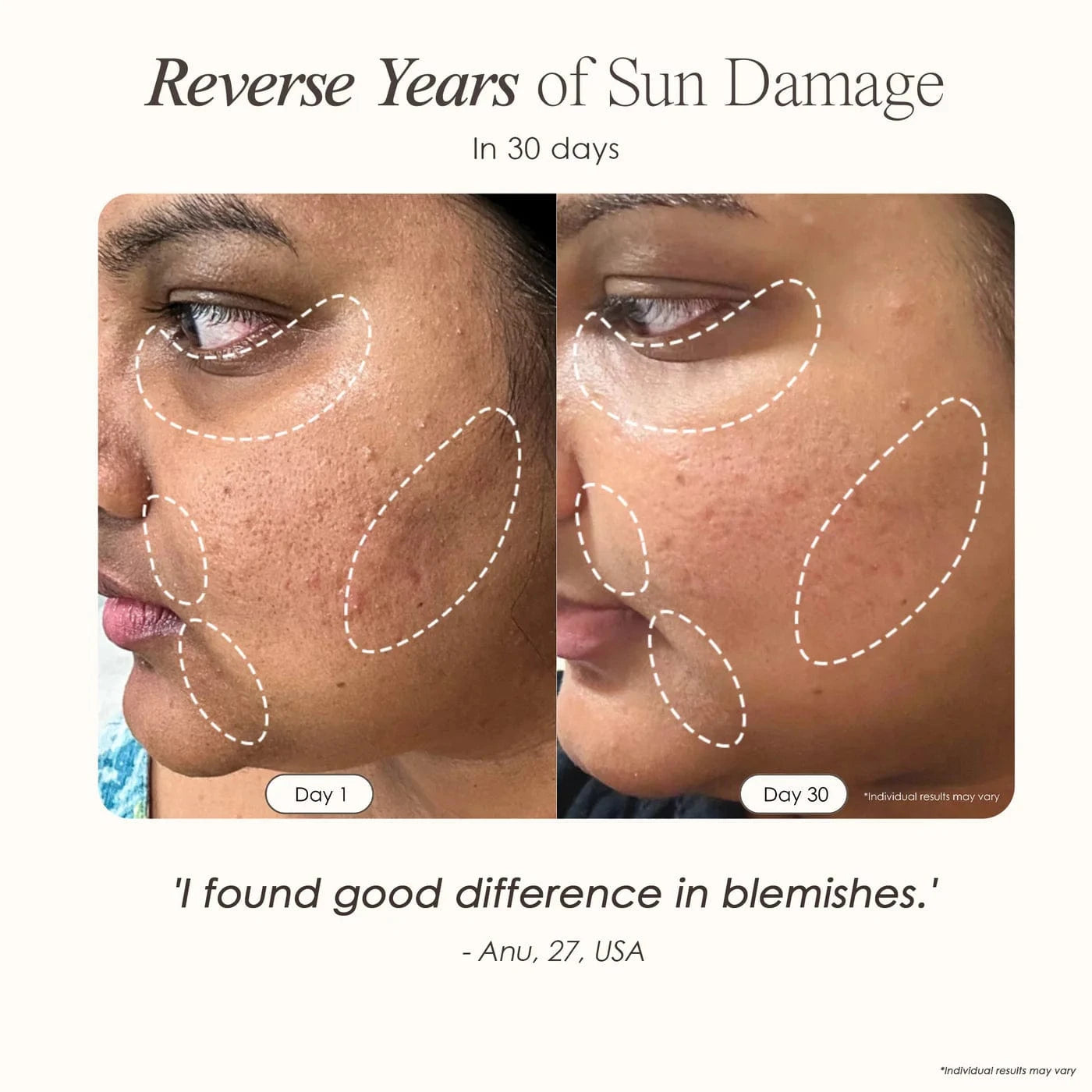Lumamask Pro | LED Light Therapy Face Mask Skin Care Project E Beauty project-e-beauty-skin-care-lumamask-pro-led-light-therapy-face-mask-1158719720