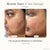 Lumamask Pro | LED Light Therapy Face Mask Skin Care Project E Beauty project-e-beauty-skin-care-lumamask-pro-led-light-therapy-face-mask-1158719720