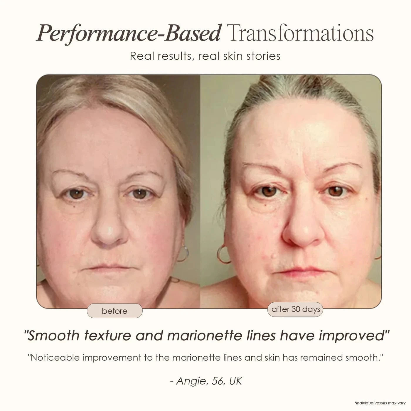 Lumamask Pro | LED Light Therapy Face Mask Skin Care Project E Beauty project-e-beauty-skin-care-lumamask-pro-led-light-therapy-face-mask-1158719725