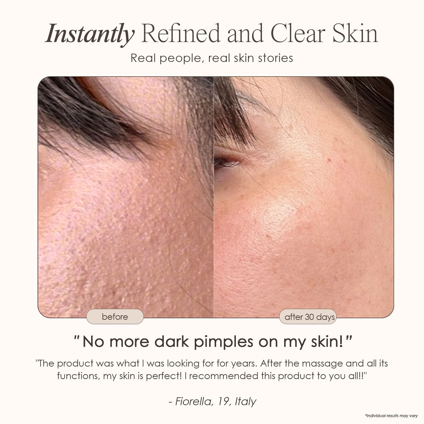 Project E Beauty Skin Care Reinvo | Facial Microdermabrasion Wand