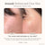 Reinvo | Facial Microdermabrasion Wand Skin Care Project E Beauty project-e-beauty-skin-care-reinvo-facial-microdermabrasion-wand-1159432332
