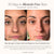 Reinvo | Facial Microdermabrasion Wand Skin Care Project E Beauty project-e-beauty-skin-care-reinvo-facial-microdermabrasion-wand-1159432333