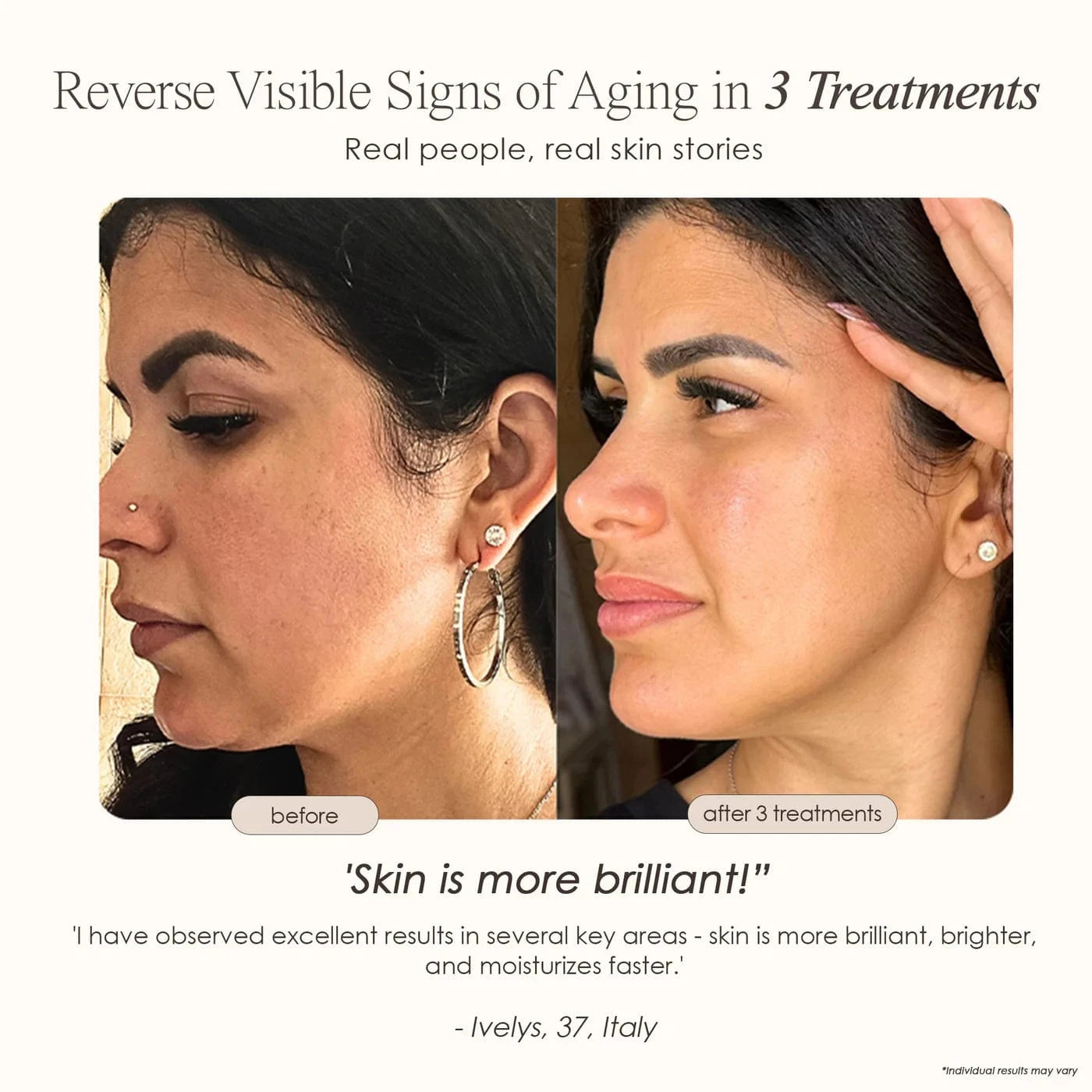 REVA | Instant Age Renewal Wand Skin Care Project E Beauty project-e-beauty-skin-care-reva-instant-age-renewal-wand-1158719756