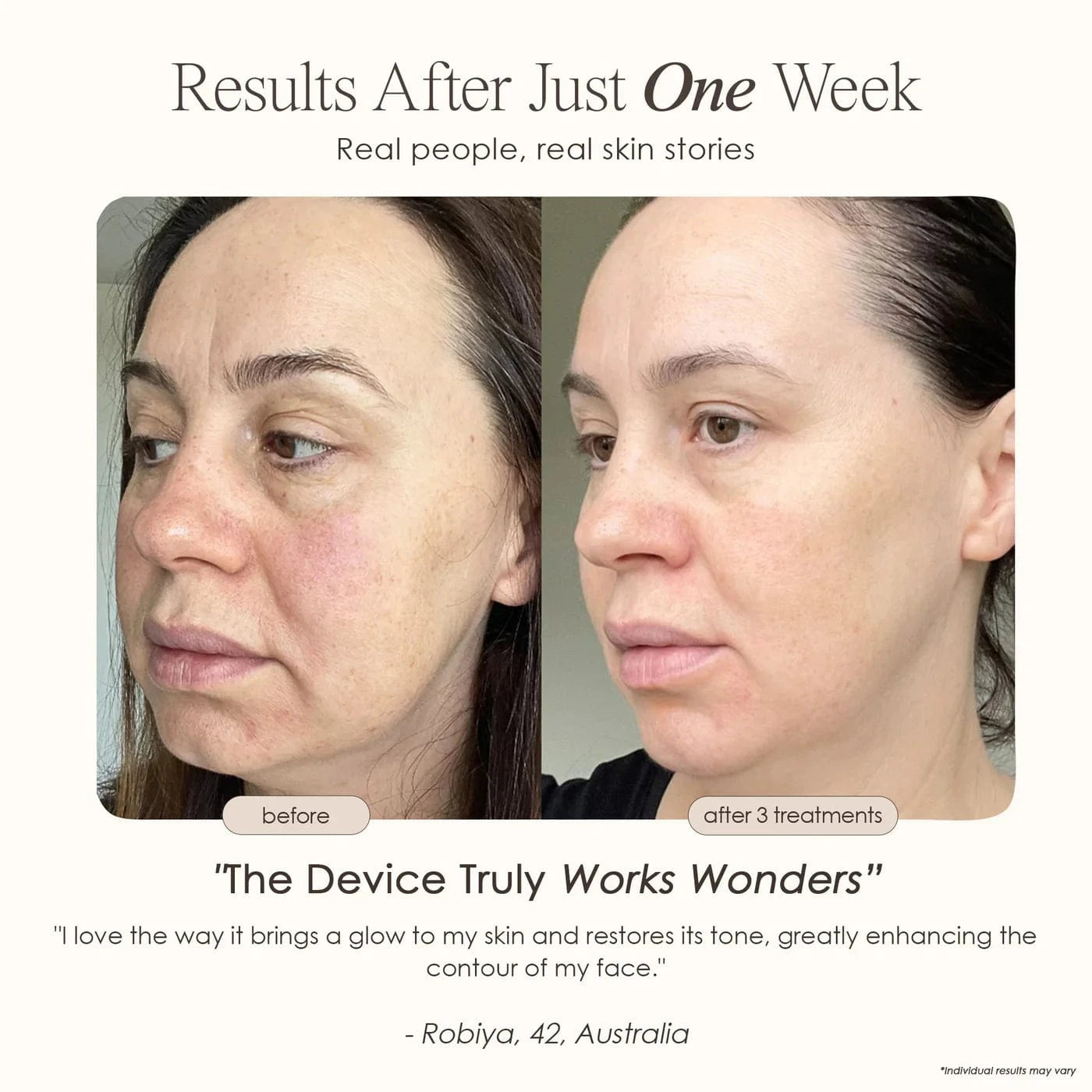 REVA | Instant Age Renewal Wand Skin Care Project E Beauty project-e-beauty-skin-care-reva-instant-age-renewal-wand-1158719760