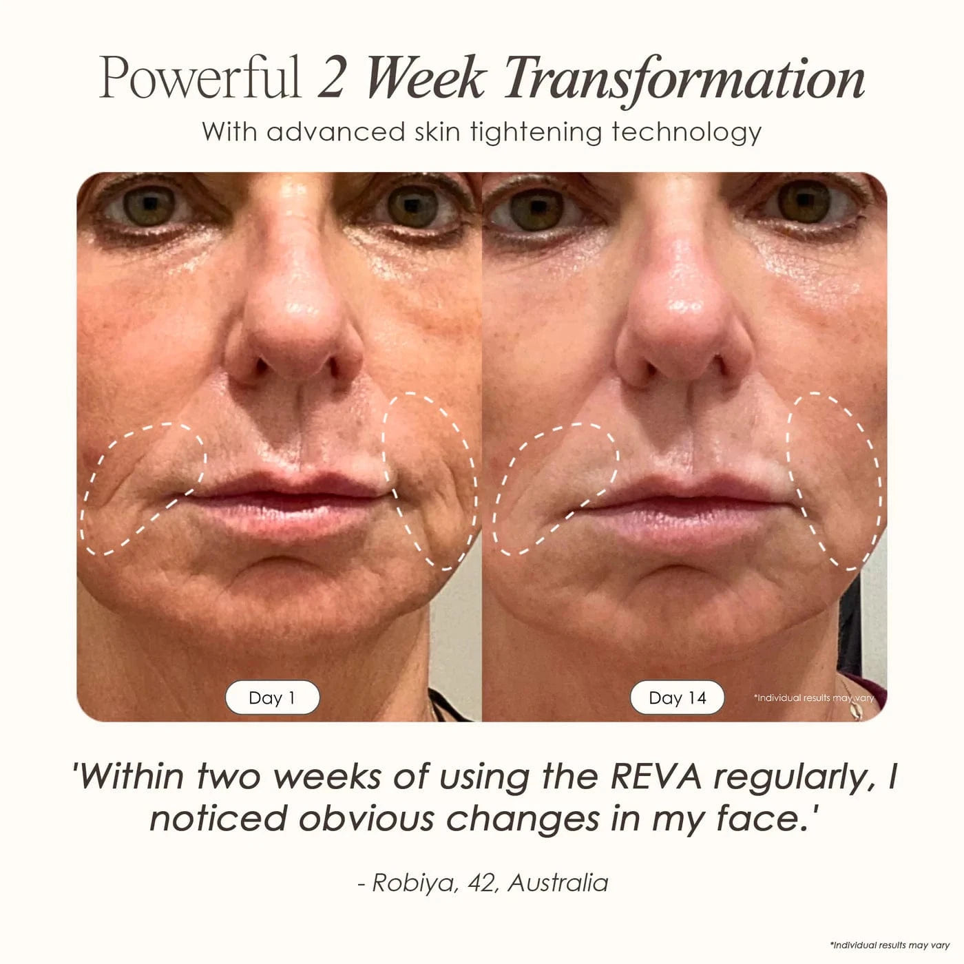 REVA | Instant Age Renewal Wand Skin Care Project E Beauty project-e-beauty-skin-care-reva-instant-age-renewal-wand-1158719765