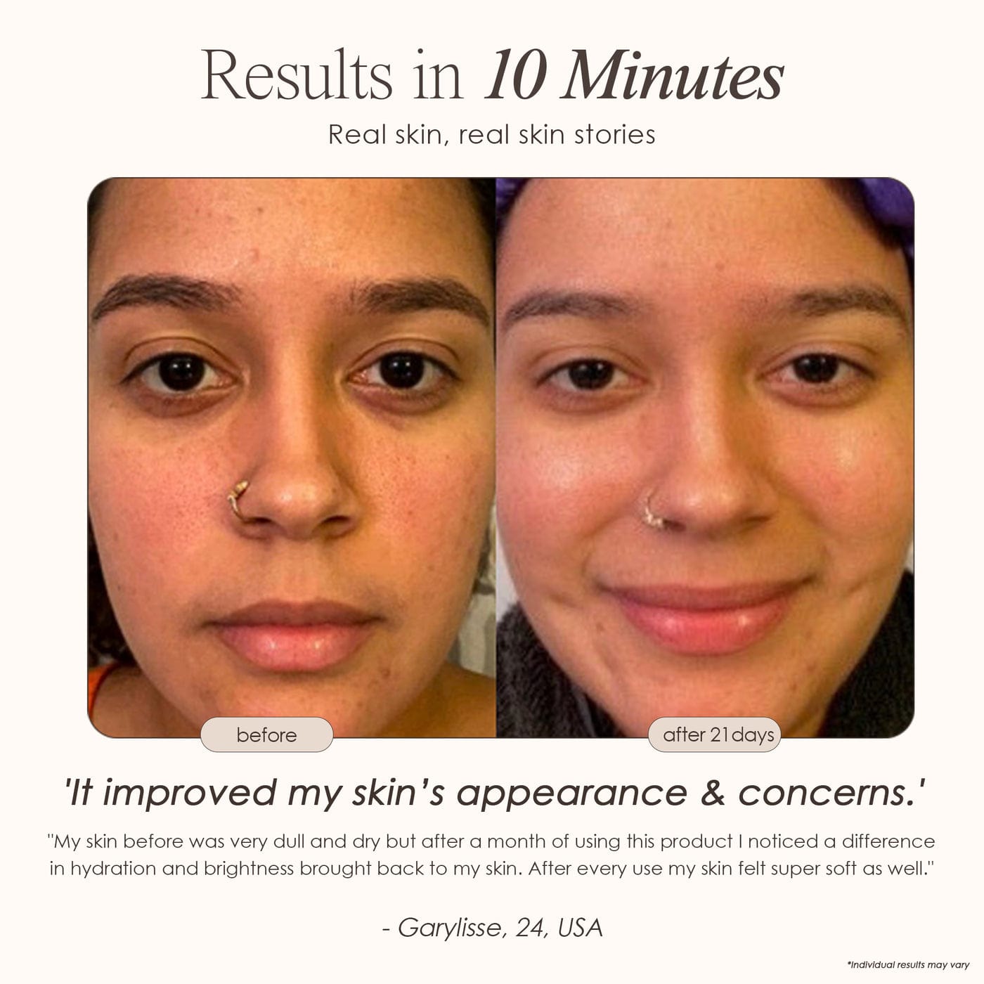 Sensa | Nano Ionic Facial Steamer Skin Care Project E Beauty project-e-beauty-skin-care-sensa-nano-ionic-facial-steamer-1159432318