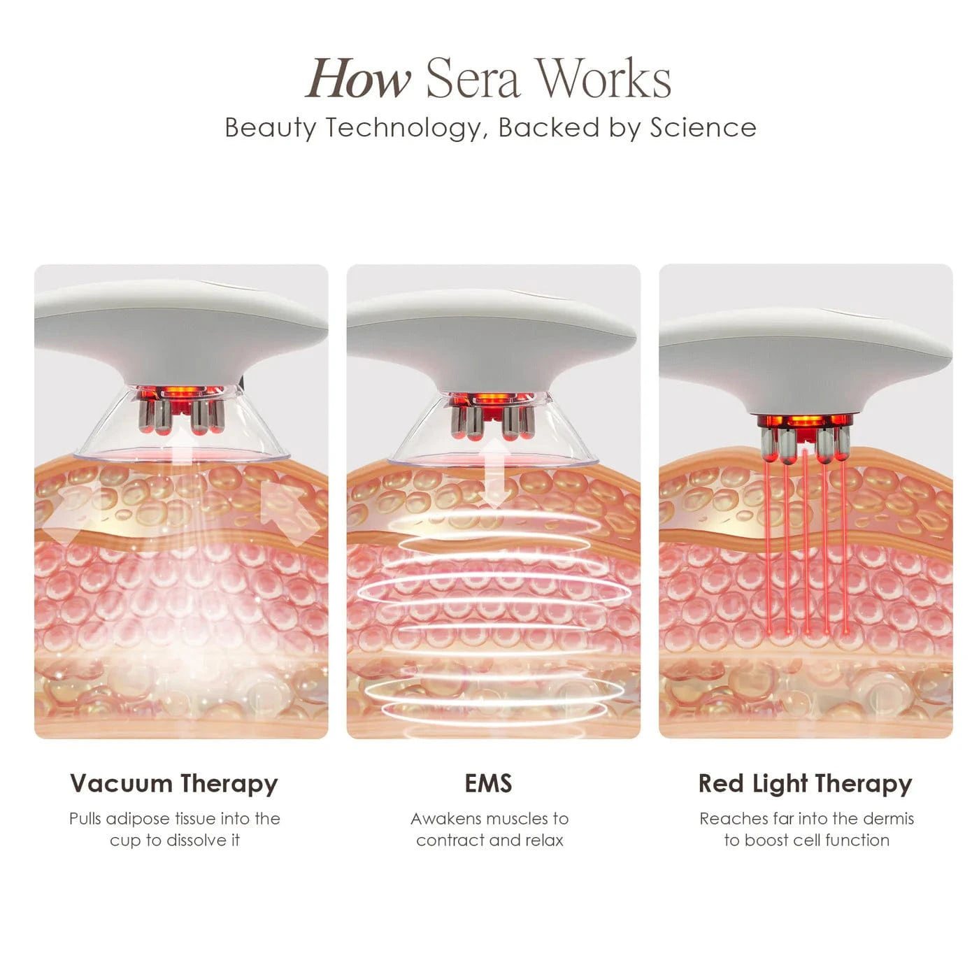 SERA | Vacuum Body Contour Device Skin Care Project E Beauty project-e-beauty-skin-care-sera-vacuum-body-contour-device-1158719745