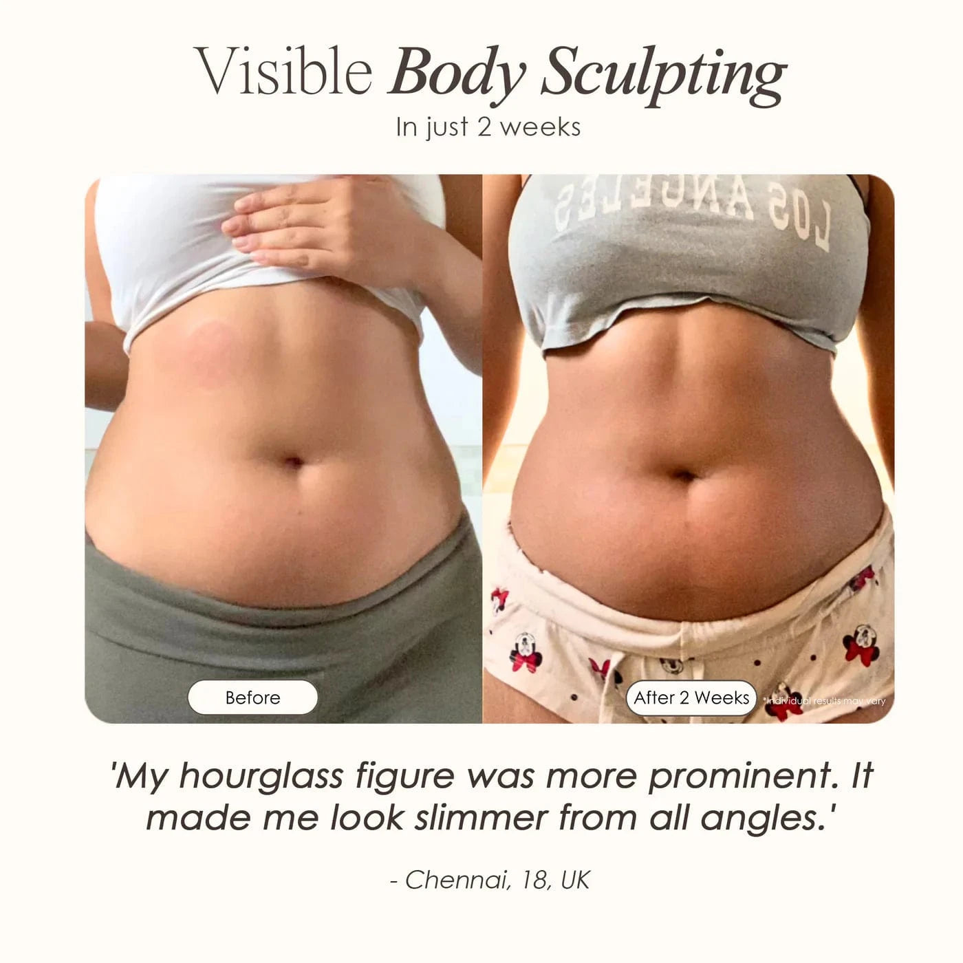 SERA | Vacuum Body Contour Device Skin Care Project E Beauty project-e-beauty-skin-care-sera-vacuum-body-contour-device-1158719747