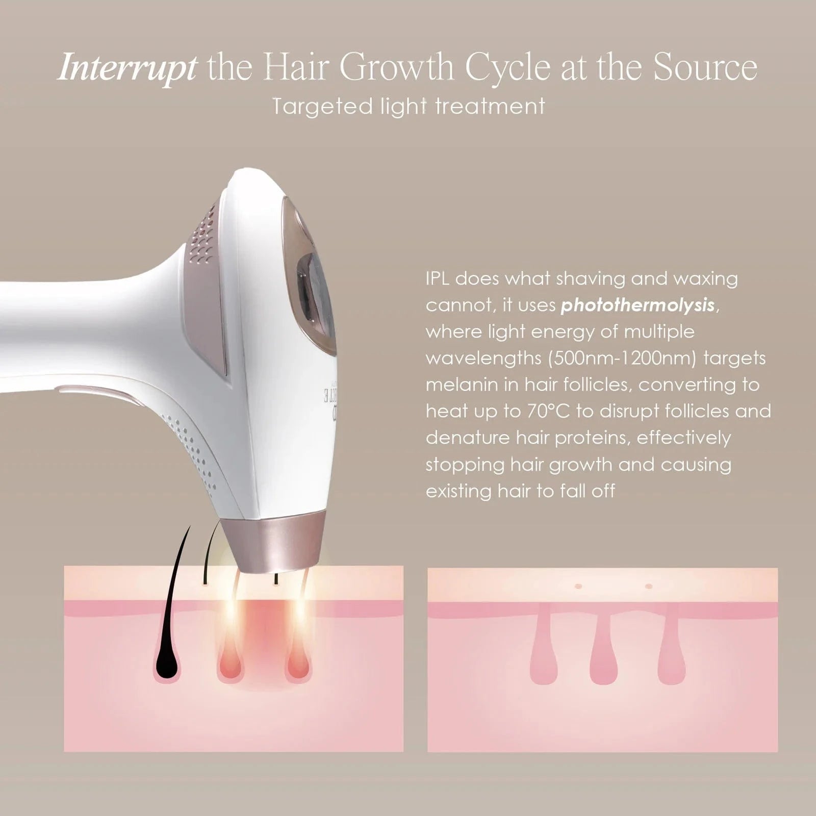 SmoothPro+ | IPL Hair Removal Device Skin Care Project E Beauty project-e-beauty-skin-care-smoothpro-ipl-hair-removal-device-1160874673