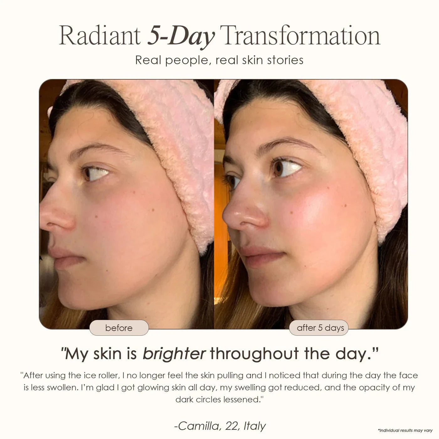 The Ice Roller | Cryotherapy Treatment Skin Care Project E Beauty project-e-beauty-skin-care-the-ice-roller-cryotherapy-treatment-1158703175