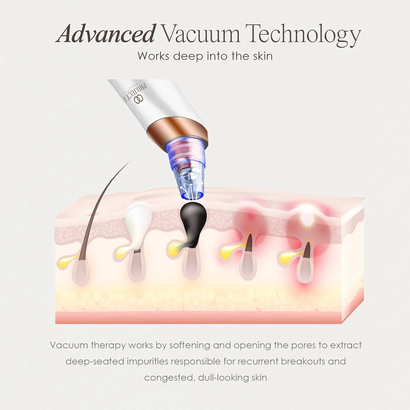 Vana | Blackhead Removal Pore Vacuum Skin Care Project E Beauty project-e-beauty-skin-care-vana-blackhead-removal-pore-vacuum-1158703168