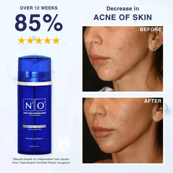 Age-Defiance Serum N¹O¹ reverieluxe-age-defiance-serum-1172885804